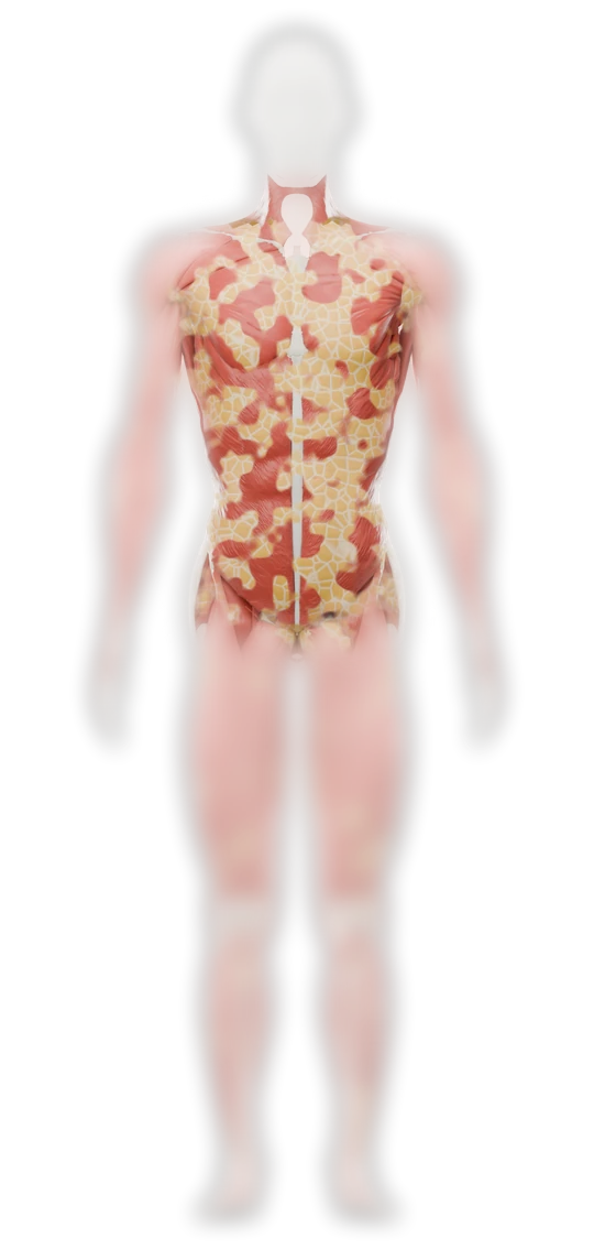 Body map with the trunk in focus: yellow fat tissue over red muscle